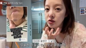 202604081410022110_1