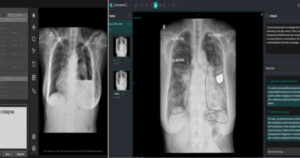 20260419091235707dvbd