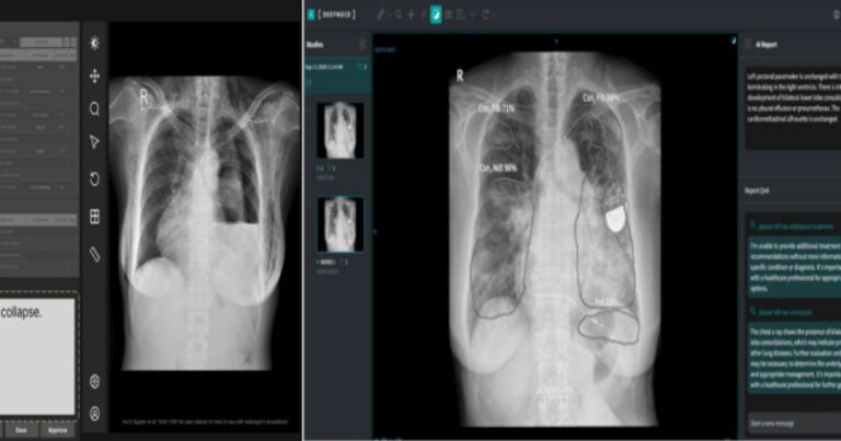 20260419091235707dvbd